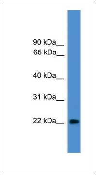 Anti-NUDT16L1 antibody produced in rabbit affinity isolated antibody