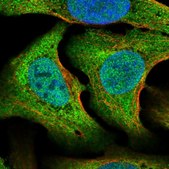 Anti-STRN3 antibody produced in rabbit Ab1, Prestige Antibodies® Powered by Atlas Antibodies, affinity isolated antibody, buffered aqueous glycerol solution