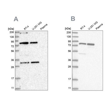 Anti-NOA1 antibody produced in rabbit Prestige Antibodies® Powered by Atlas Antibodies, affinity isolated antibody, buffered aqueous glycerol solution