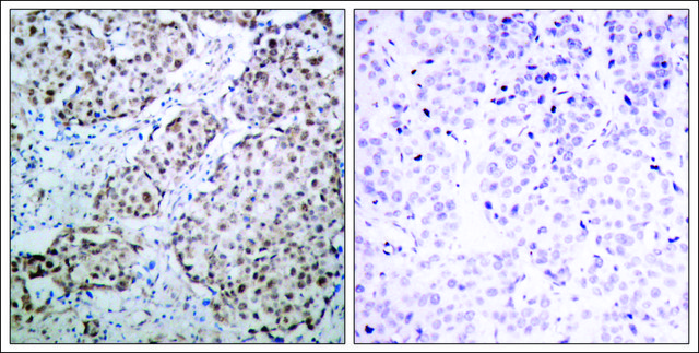 Anti-phospho-TP53 (pSer315) antibody produced in rabbit affinity isolated antibody