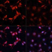 Anti-Phospho-P70 S6K-T389 antibody produced in rabbit