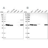 Anti-RALY antibody produced in rabbit Prestige Antibodies® Powered by Atlas Antibodies, affinity isolated antibody, buffered aqueous glycerol solution