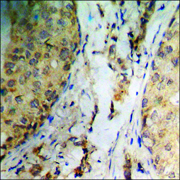 Anti-phospho-Catenin-&#946; (pSer37) antibody produced in rabbit affinity isolated antibody