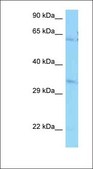Anti-PPCS antibody produced in rabbit affinity isolated antibody