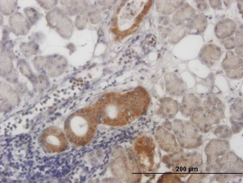 Monoclonal Anti-ALS2CR8 antibody produced in mouse clone 2A3, purified immunoglobulin, buffered aqueous solution