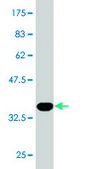 Monoclonal Anti-S100P antibody produced in mouse clone 4E7, purified immunoglobulin, buffered aqueous solution