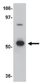 Anti-APC8 Antibody from rabbit, purified by affinity chromatography