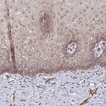 Anti-FUT10 antibody produced in rabbit Prestige Antibodies&#174; Powered by Atlas Antibodies, affinity isolated antibody, buffered aqueous glycerol solution