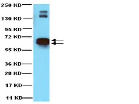 Anti-Glutamate Decarboxylase 65 &amp; 67 Antibody Chemicon&#174;, from rabbit