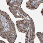 Anti-SUCLG1 antibody produced in rabbit Prestige Antibodies® Powered by Atlas Antibodies, affinity isolated antibody, buffered aqueous glycerol solution