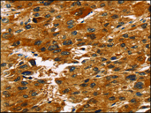 Anti-TACC2 affinity isolated antibody