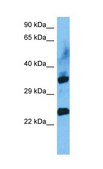 Anti-FADD (AB2) antibody produced in rabbit affinity isolated antibody