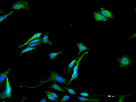 Anti-GNPAT antibody produced in rabbit purified immunoglobulin, buffered aqueous solution