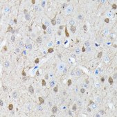 Anti-PGP9.5/UCHL1 antibody produced in rabbit