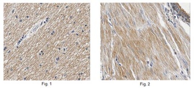 抗-TRPM4抗体 from rabbit, purified by affinity chromatography