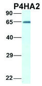 Anti-P4HA2 (C-terminal) antibody produced in rabbit affinity isolated antibody