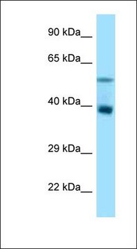 Anti-TRIM7 antibody produced in rabbit affinity isolated antibody