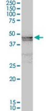 Anti-ART3 antibody produced in rabbit purified immunoglobulin, buffered aqueous solution