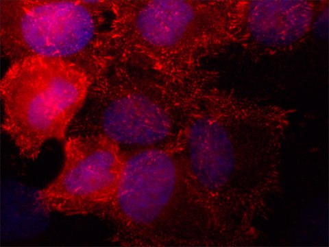 Anti-SORBS2 antibody,Mouse monoclonal clone S5C, purified from hybridoma cell culture