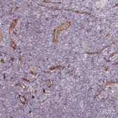 Anti-CD34 antibody produced in rabbit Prestige Antibodies&#174; Powered by Atlas Antibodies, affinity isolated antibody, buffered aqueous glycerol solution