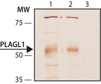 Anti-PLAGL1 antibody produced in rabbit ~1.0 mg/mL, affinity isolated antibody, buffered aqueous solution