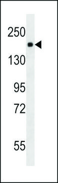 MONOCLONAL ANTI-PDGFR antibody produced in mouse clone 275CT1, crude ascites, buffered aqueous solution