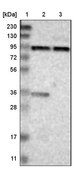 Anti-KIAA1024 antibody produced in rabbit Prestige Antibodies® Powered by Atlas Antibodies, affinity isolated antibody, buffered aqueous glycerol solution