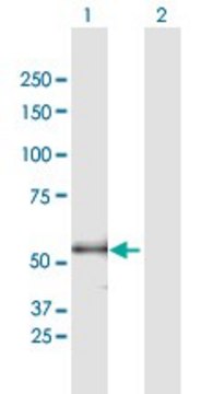 Anti-ENTPD3 antibody produced in mouse purified immunoglobulin, buffered aqueous solution