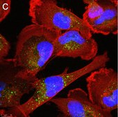 Anti-p62/SQSTM1 Antibody, clone 2D14 ZooMAb® Rabbit Monoclonal recombinant, expressed in HEK 293 cells