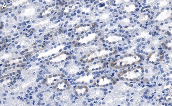 Anti-LPCAT1 Antibody, clone 1H15 ZooMAb&#174; Rabbit Monoclonal recombinant, expressed in HEK 293 cells