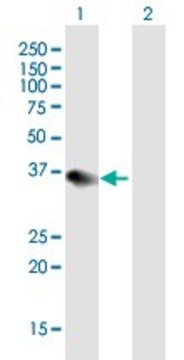 Anti-SHARPIN antibody produced in mouse purified immunoglobulin, buffered aqueous solution