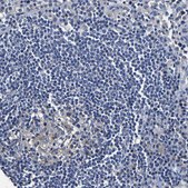 Anti-SLCO2B1 antibody produced in rabbit Prestige Antibodies® Powered by Atlas Antibodies, affinity isolated antibody, buffered aqueous glycerol solution