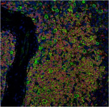 Anti-Hypusine Antibody Antibody from rabbit, purified by affinity chromatography