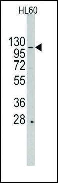 Anti-HIRA (center) antibody produced in rabbit saturated ammonium sulfate (SAS) precipitated, buffered aqueous solution