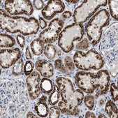 Anti-SLC25A13 antibody produced in rabbit Prestige Antibodies® Powered by Atlas Antibodies, affinity isolated antibody, buffered aqueous glycerol solution