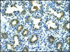 Anti-GUSB antibody produced in rabbit IgG fraction of antiserum