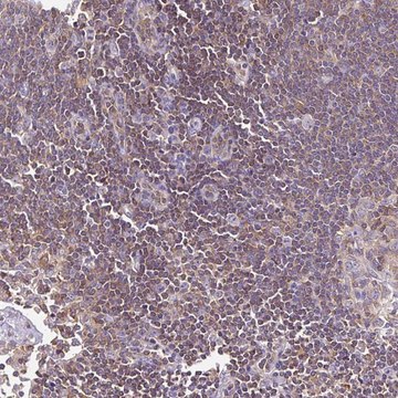 Anti-TWF2 antibody produced in rabbit Prestige Antibodies&#174; Powered by Atlas Antibodies, affinity isolated antibody, buffered aqueous glycerol solution