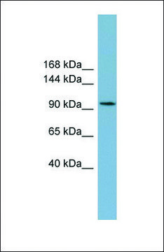 Anti-SLC12A3 antibody produced in rabbit affinity isolated antibody