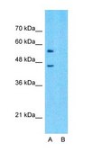 Anti-SLC15A4 antibody produced in rabbit affinity isolated antibody