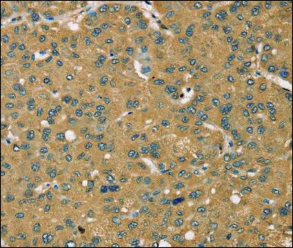 Anti-KDM5A antibody produced in rabbit affinity isolated antibody