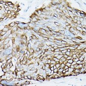 Anti-MUC1 antibody produced in rabbit