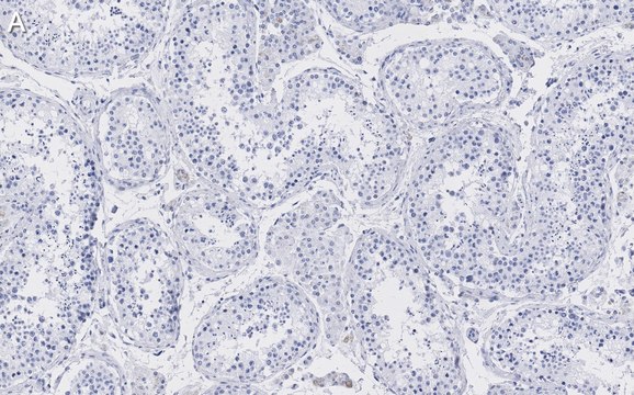 Anti-Golgin-97 Antibody, clone 4K16, ZooMAb&#174; Rabbit Monoclonal recombinant, expressed in HEK 293 cells