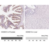 Anti-HOXB13 antibody produced in rabbit Prestige Antibodies® Powered by Atlas Antibodies, affinity isolated antibody, buffered aqueous glycerol solution