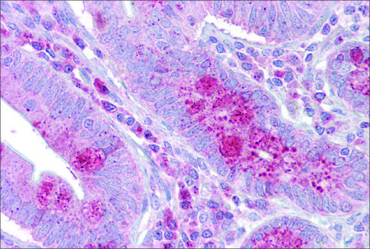 Anti-OAS1 (ab3) antibody produced in rabbit affinity isolated antibody