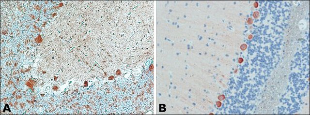 Anti-Myosin Va (LF-18) antibody produced in rabbit ~0.4&#160;mg/mL, affinity isolated antibody, buffered aqueous solution