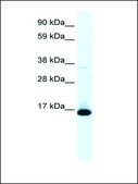 Anti-TCF21 antibody produced in rabbit affinity isolated antibody