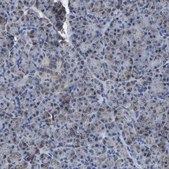 Anti-ETFA antibody produced in rabbit Prestige Antibodies® Powered by Atlas Antibodies, affinity isolated antibody, buffered aqueous glycerol solution