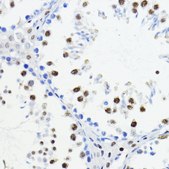 Anti-ZEB1 antibody produced in rabbit