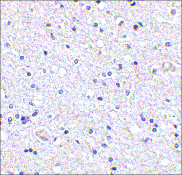 Anti-TSLP (ab2) antibody produced in rabbit affinity isolated antibody, buffered aqueous solution