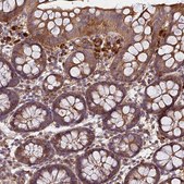 Anti-C17ORF62 antibody produced in rabbit Prestige Antibodies® Powered by Atlas Antibodies, affinity isolated antibody, buffered aqueous glycerol solution